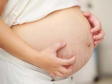Η καισαρική είναι ασφαλής μέθοδος τοκετού ακόμα και όταν έχει ήδη προηγηθεί άλλη
