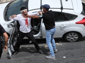 Νέα βίαια επεισόδια με περισσότερους από 300 τραυματίες στην Ιερουσαλήμ
