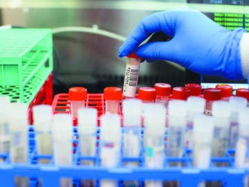 Το εμβόλιο Covid-19 προσφέρει «υπερανοσία» σε όσους είχαν επιζήσει από SARS