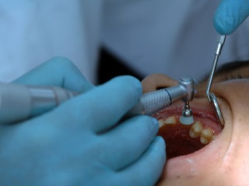 Τέλος τα rapid test για τα οδοντιατρεία – Αποφάσεις της επιτροπής μετά τη θύελλα