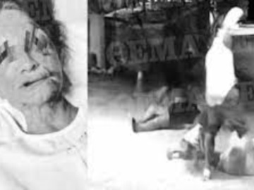 Αίγινα: Φωτογραφίες-ντοκουμέντο από τον άγριο ξυλοδαρμό του ξενοδόχου