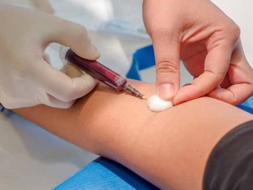Εξετάσεις αίματος: Βάζει «φρένο» ο ΕΟΠΥΥ - Πότε θα αποζημιώνονται