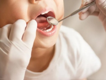 Dentist Pass: Τι παρέχει και πότε λήγει η προθεσμία για τις αιτήσεις