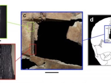Ισραήλ: Βρέθηκε κρανίο με τετράγωνη τρύπα – Ενδειξη για χειρουργική εγκεφάλου πριν 3.500 χρόνια
