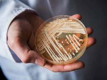 Συναγερμός στις ΗΠΑ για τον θανατηφόρο μύκητα Candida auris: Γίνεται πιο ανθεκτικός - Τι δείχνει νέα μελέτη